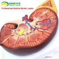 KIDNEY02 (12431) Oversize Plastic Kidney mit Stand 3 Time Vergrößern Life Size Medizinische Anatomie